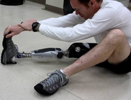 How To Optimize Battery Management In Powered Prosthetics？